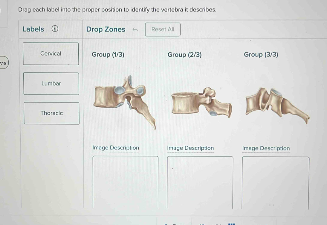 Drag each label into the proper position to identify the vertebra it describes. 
Labels Drop Zones Reset All 
Cervical Group (1/3) Group (2/3) Group (3/3)
7:16
Lumbar 
Thoracic 
Image Description Image Description Image Description