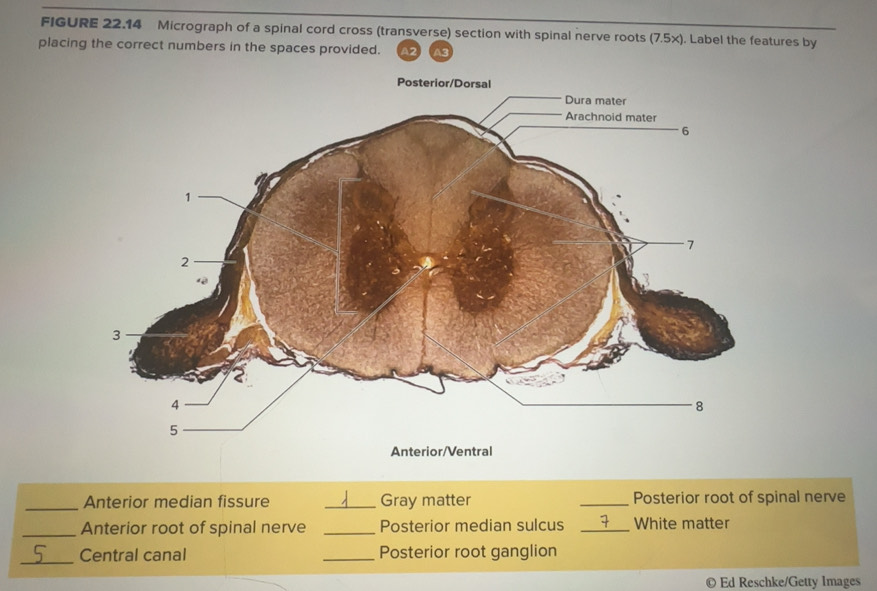 Solved: FIGURE 22.14 Micrograph of a spinal cord cross (transverse ...