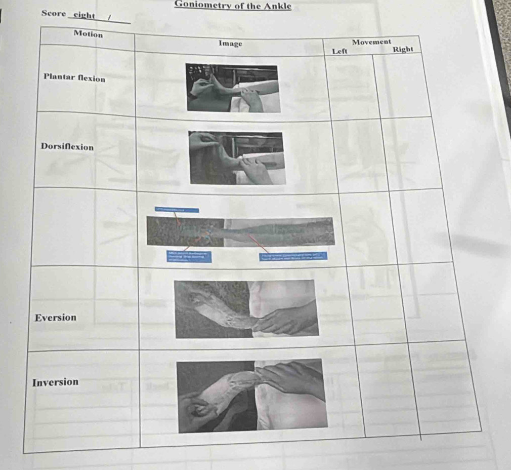 Goniometry of the Ankle 
Score eight