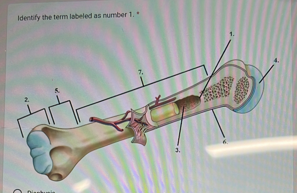 Identify the term labeled as number 1. *