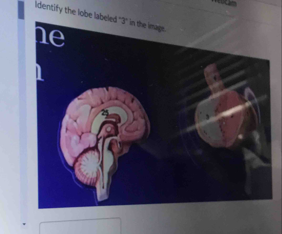 Wedcam 
Identify the lobe