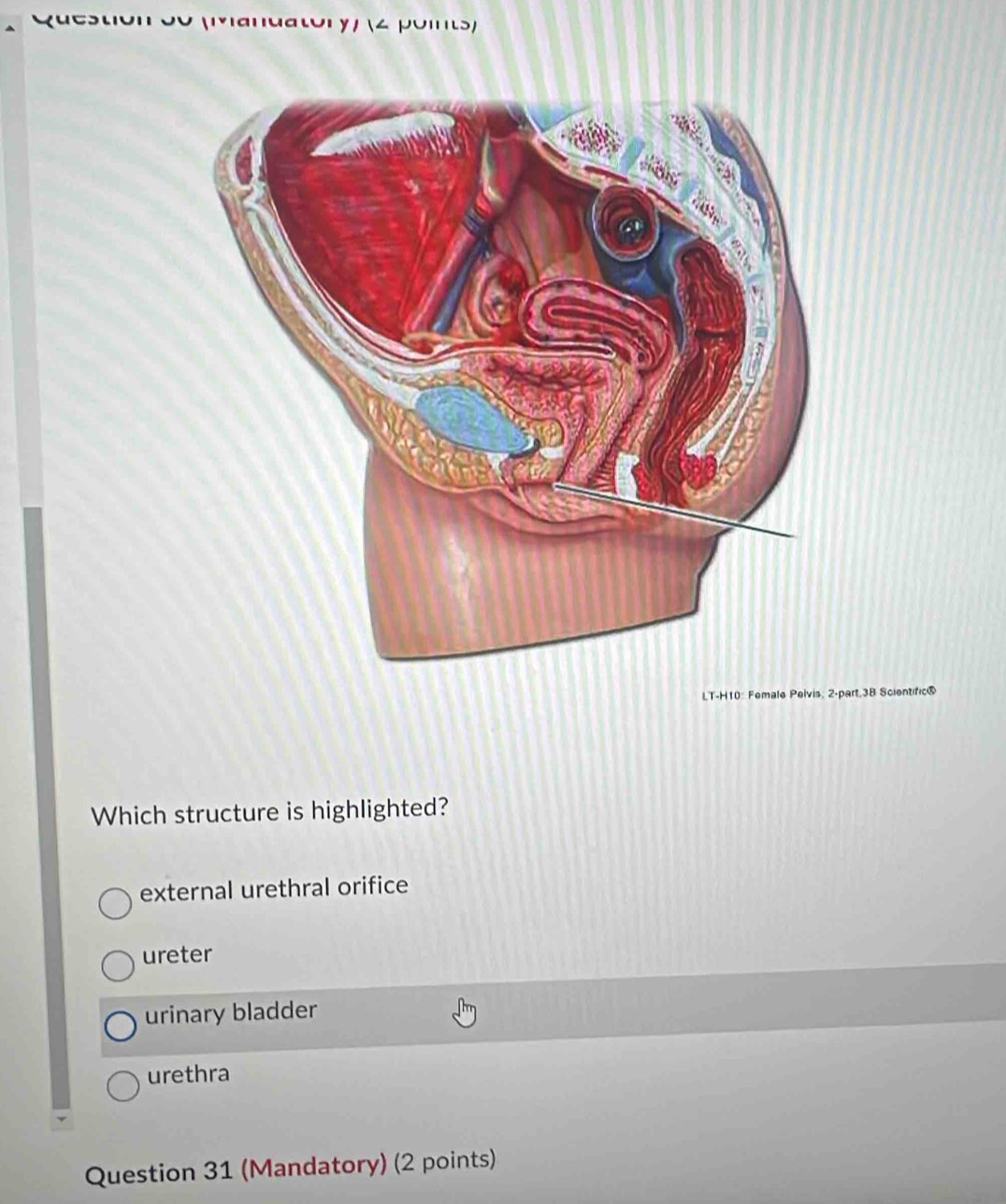 pois
LT-H10: Female Pelvis, 2-part.3B Scientific®
Which structure is highlighted?
external urethral orifice
ureter
urinary bladder
urethra
Question 31 (Mandatory) (2 points)