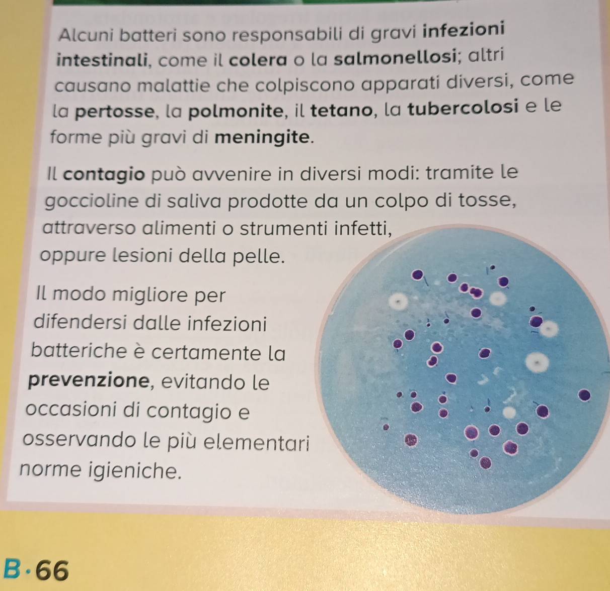 Alcuni batteri sono responsabili di gravi infezioni
intestinali, come il colera o la salmonellosi; altri
causano malattie che colpiscono apparati diversi, come
la pertosse, la polmonite, il tetano, la tubercolosi e le
forme più gravi di meningite.
Il contagio può avvenire in diversi modi: tramite le
goccioline di saliva prodotte da un colpo di tosse,
attraverso alimenti o strume
oppure lesioni della pelle.
Il modo migliore per
difendersi dalle infezioni
batteriche è certamente la
prevenzione, evitando le
occasioni di contagio e
osservando le più elementar
norme igieniche.
B. 66