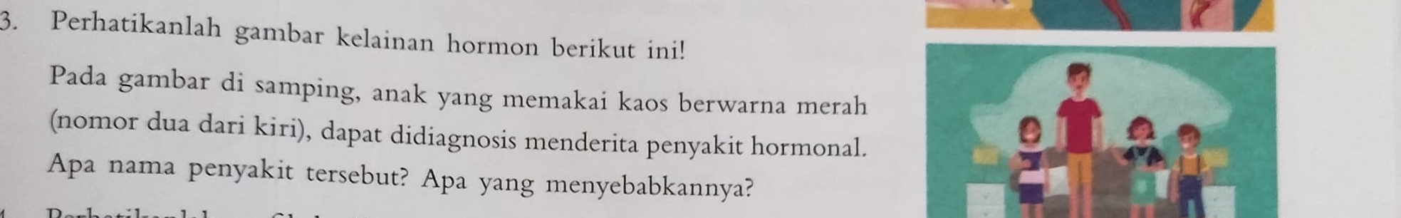 Perhatikanlah gambar kelainan hormon berikut ini! 
Pada gambar di samping, anak yang memakai kaos berwarna merah 
(nomor dua dari kiri), dapat didiagnosis menderita penyakit hormonal. 
Apa nama penyakit tersebut? Apa yang menyebabkannya?