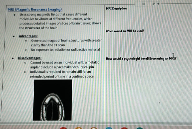 MRI (Magnelic Resonance Imaging): MRI Description:
Uses strong magnetic fields that cause different
molecules to vibrate at different frequencies, which
produces detailed images of slices of brain tissues; shows
the structures of the brain
When would an MRI be used?
Advantages:
Generates images of brain structures with greater
clarity than the CT scan
No exposure to radiation or radioactive material
Disadvantages: How would a psychologist benefit from using an Mici?
Cannot be used on an individual with a metallic
implant include a pacemaker or surgical pin
Individual is required to remain still for an
extended period of time in a confined space