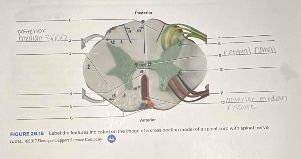 Solved: FIGURE 28.15 Label the features indicated on the image of a ...