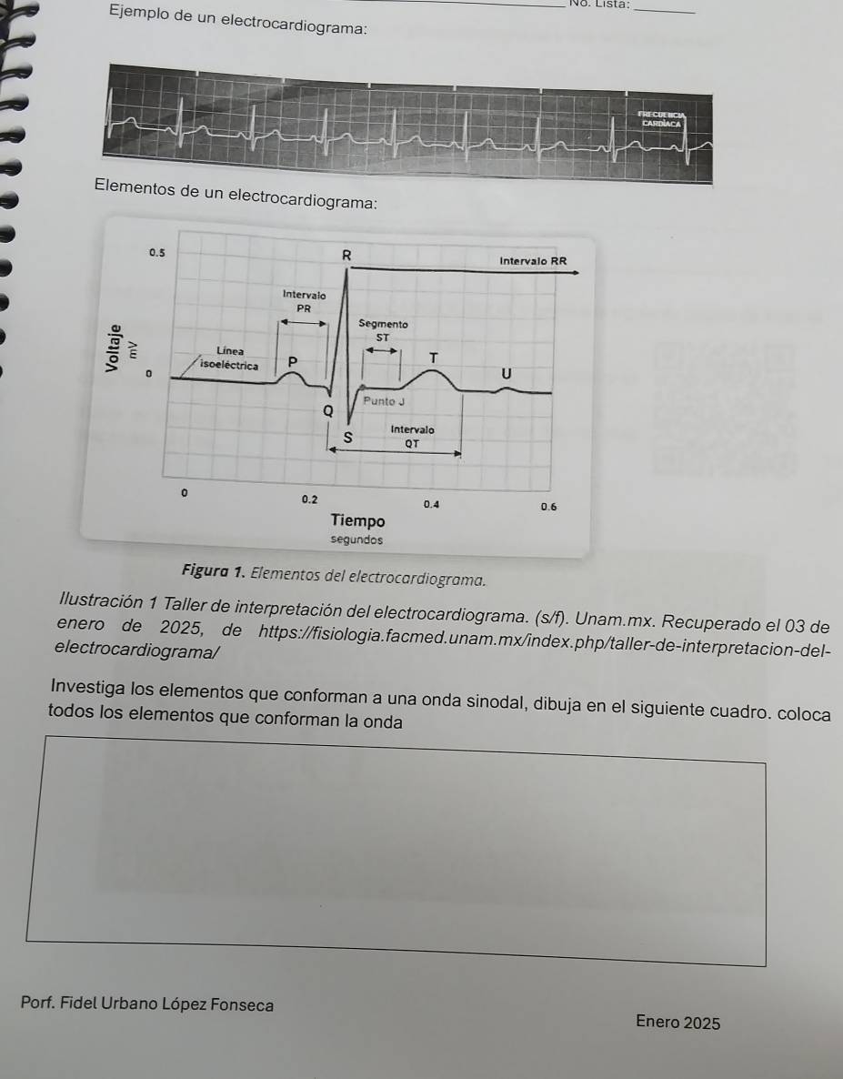 No. Lista:_ 
Ejemplo de un electrocardiograma: 
rocardiograma: 
Figura 1. Elementos del electrocardiograma. 
Ilustración 1 Taller de interpretación del electrocardiograma. (s/f). Unam.mx. Recuperado el 03 de 
enero de 2025, de https://fisiologia.facmed.unam.mx/index.php/taller-de-interpretacion-del- 
electrocardiograma/ 
Investiga los elementos que conforman a una onda sinodal, dibuja en el siguiente cuadro. coloca 
todos los elementos que conforman la onda 
Porf. Fidel Urbano López Fonseca Enero 2025