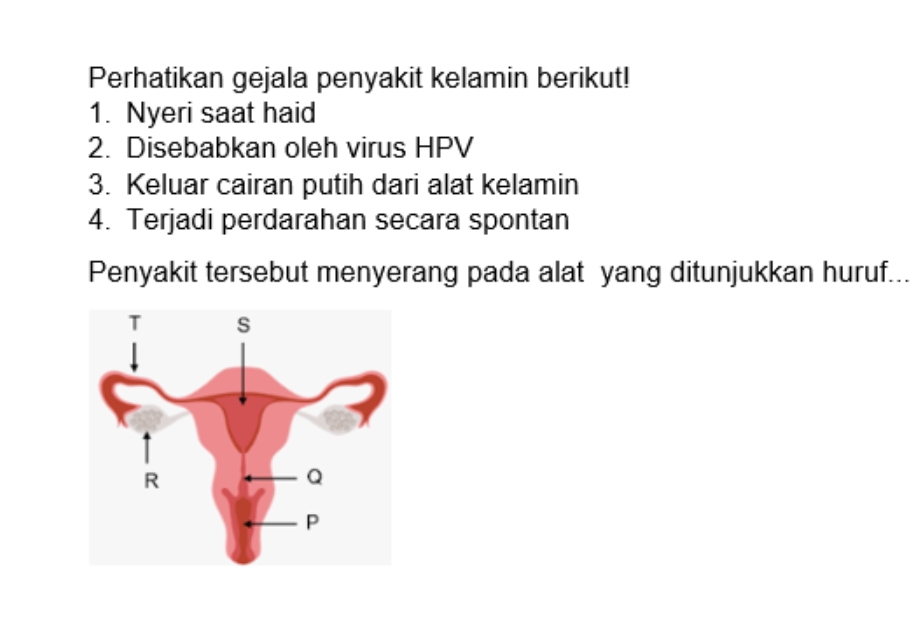 Perhatikan gejala penyakit kelamin berikut! 
1. Nyeri saat haid 
2. Disebabkan oleh virus HPV 
3. Keluar cairan putih dari alat kelamin 
4. Terjadi perdarahan secara spontan 
Penyakit tersebut menyerang pada alat yang ditunjukkan huruf...