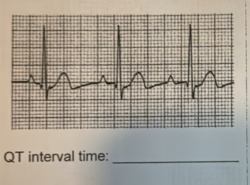 QT interval time:_