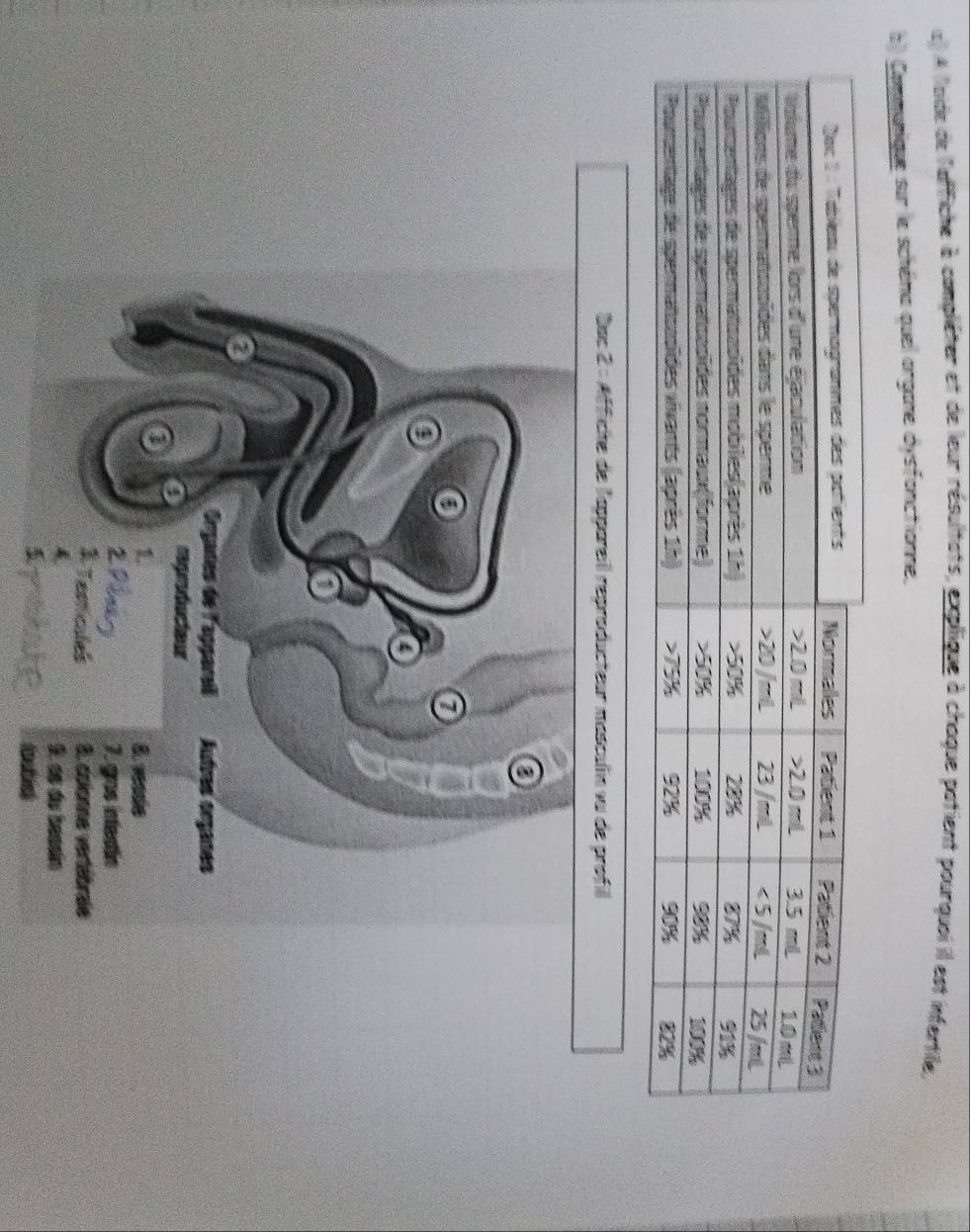 À loide de l'affiche à compliéter et de leur résultats, explique à chaque patient pourquoi il est infertile, 
b) Communique sur le schéna quel organe dysfonctionne. 
Dac 2 : Affiche de l'appareil reproducteur masculn vu de profil