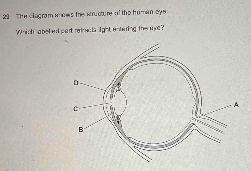 The diagram shows the structure of the human eye. 
Which labelled part refracts light entering the eye?