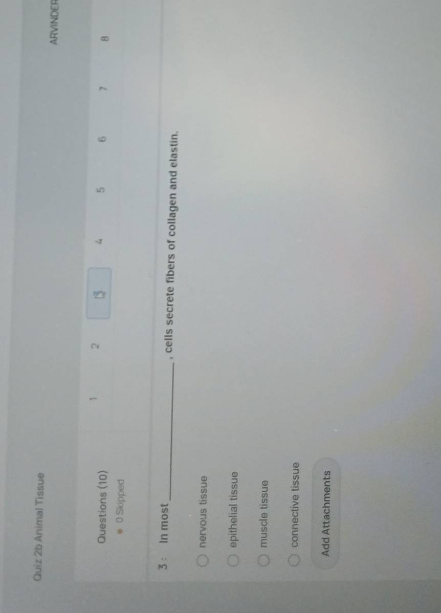 Animal Tissue
ARVINDER
1 2
Questions (10) 1 5 6 7 8
0 Skipped
3 : In most _, cells secrete fibers of collagen and elastin.
nervous tissue
epithelial tissue
muscle tissue
connective tissue
Add Attachments