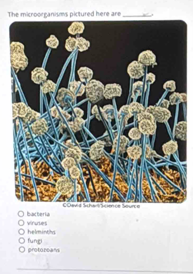 The microorganisms pictured here are _.
bacteria
viruses
helminths
fungi
protozoans
_
_