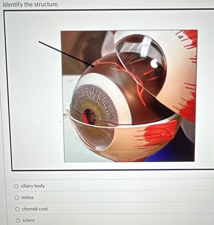 Identify the structure.
ciliary body
retina
choroid coat
sclera