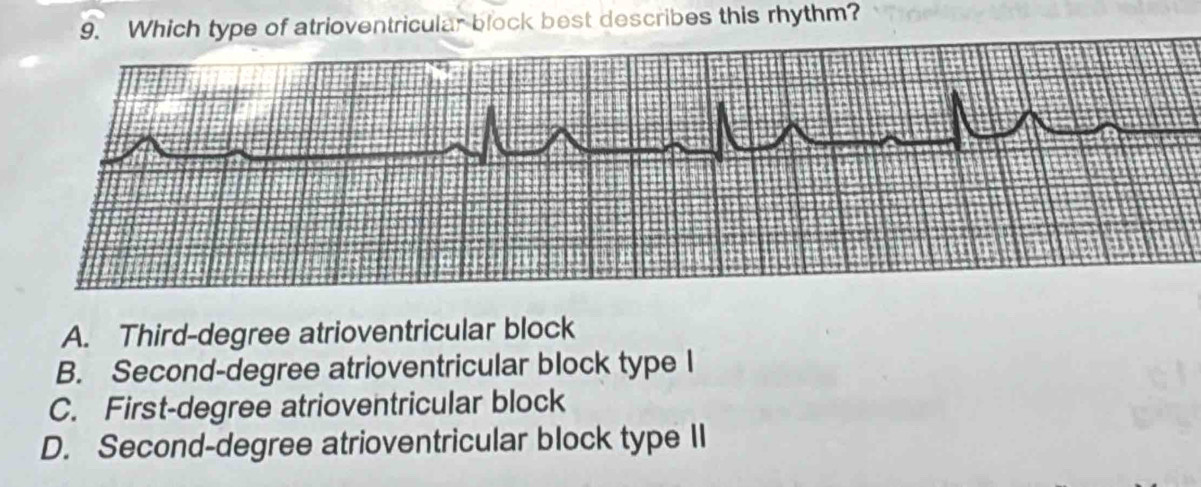 Solved: Which type of atrioventricular block best describes this rhythm ...