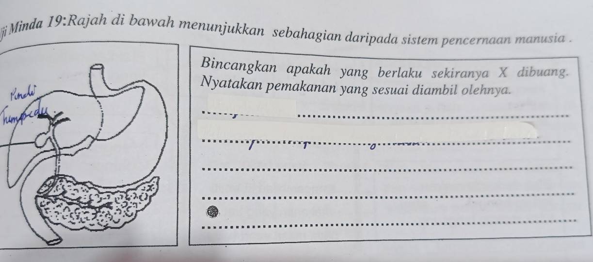 jMinda 19:Rajah di bawah menunjukkan sebahagian daripada sistem pencernaan manusia . 
Bincangkan apakah yang berlaku sekiranya X dibuang. 
R 
Nyatakan pemakanan yang sesuai diambil olehnya. 
hime 
_ 
_ 
_ 
_ 
_ 
_