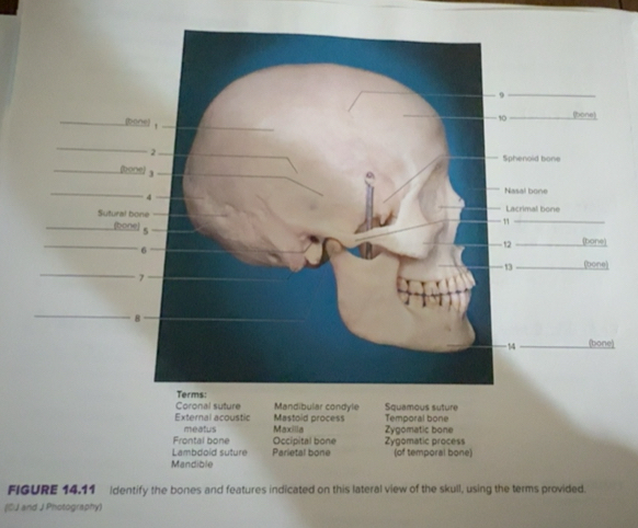 Solved: Coronal suture Mandibular condyle Squamous suture External ...