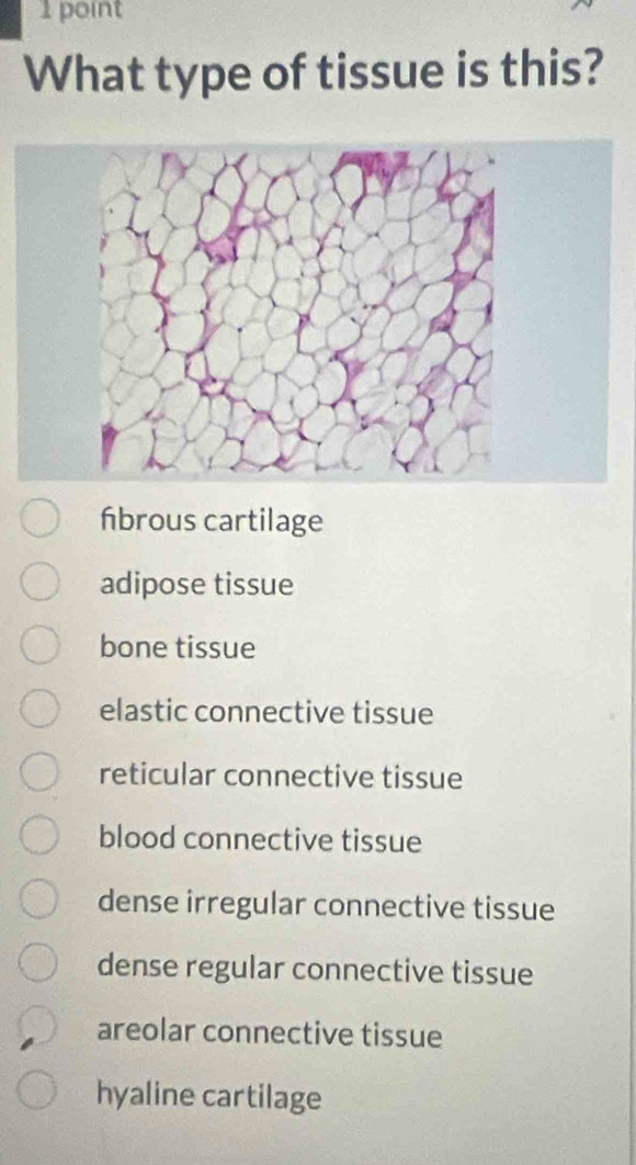 What type of tissue is this?
Ábrous cartilage
adipose tissue
bone tissue
elastic connective tissue
reticular connective tissue
blood connective tissue
dense irregular connective tissue
dense regular connective tissue
areolar connective tissue
hyaline cartilage