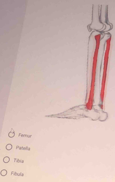 Femur
Patella
Tibia
Fibula