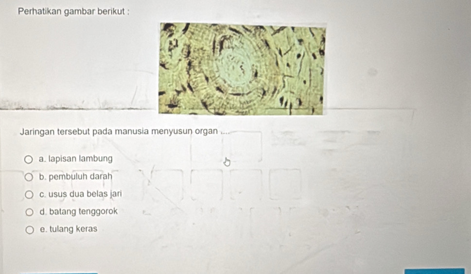 Perhatikan gambar berikut : 
Jaringan tersebut pada manusia menyusun organ 
a. lapisan lambung 
b. pembuluh darah 
c. usus dua belas jari 
d. batang tenggorok 
e. tulang keras