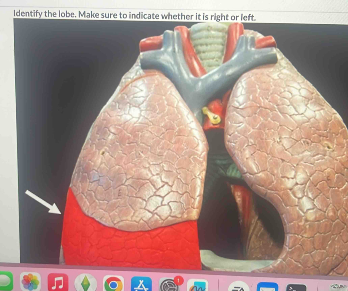 Identify the lobe. Make sure to indicate whe