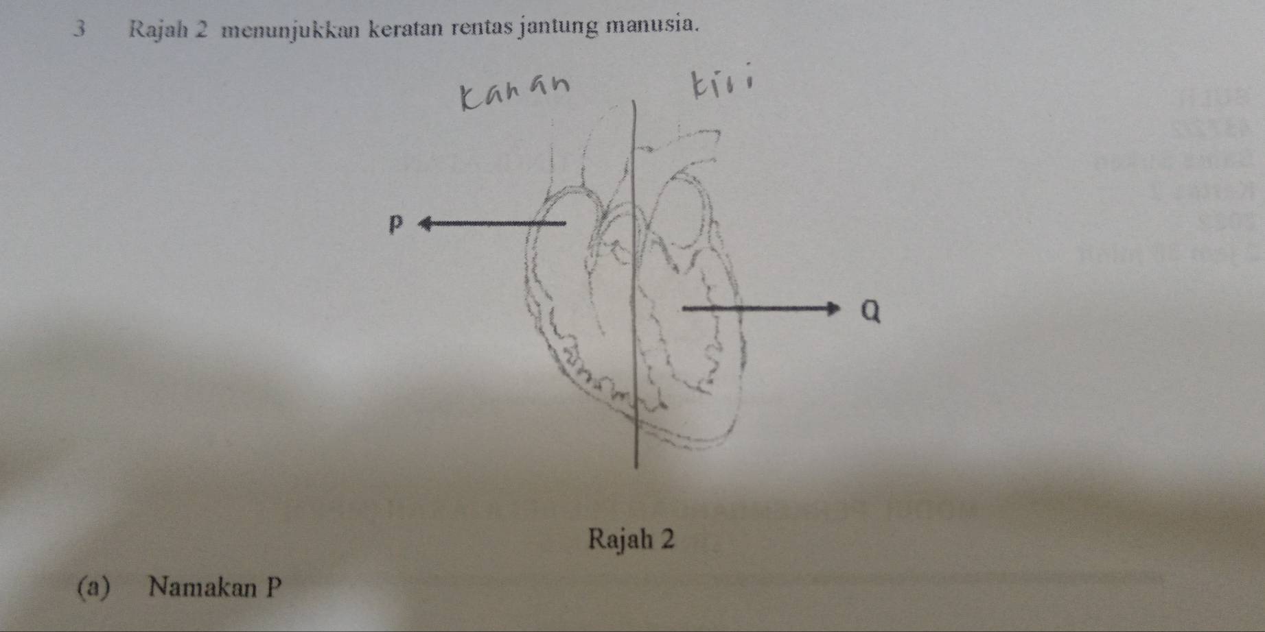 Rajah 2 menunjukkan keratan rentas jantung manusia. 
Rajah 2 
(a) Namakan P