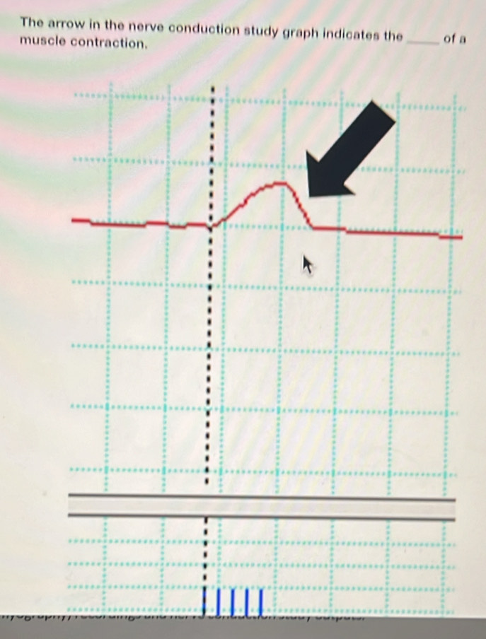 Solved: The arrow in the nerve conduction study graph indicates the ...