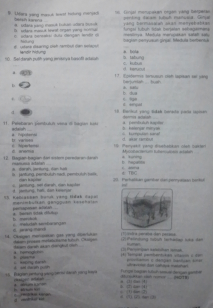 Udara yang masuk lewat hidung menjadi 16. Ginjal merupakan organ yang berperan
bersih karena penting dalam tubuh manusia. Ginjal
@. udara yang masuk bukan udara busuk yang bermasalah akan menyebabkas
b. udara masuk lewat organ yang normal  fungsi tubuh tidak berjalan sebagaimana
C. udara bereaksi dulu dengan lendir di mestinya. Medula merupakan salah satu
hidung bagian penyusun ginjal. Medula berbentuk
d. udara disaring oleh rambut dan selaput
lendir hidung a. bola
10. Sel darah putih yang jenisnya basofil adalah c. kubus b. tabung
d. kerucut
a.
17. Epidermis tersusun oleh lapisan sel yang
berjumlah ... bush.
b.
a. satu
b dua
c. c. tiga
d. empat
d
18. Berikut yang tidak berada pada lapisan
11. Pelebaran pembuluh vena di bagian kaki b. kelenjar minyak a. pembuluh kapiller
adalah
a. hipotensi d. akar rambut c. kumpulan sara!
br varises
d. anemia 19. Penyakit yang disebabkan cleh bakteri
c. hipertensi Mycobacterium tuberculosis adalah   
12. Bagian-bagian dari sistem peredaran darah b hepatitis a kuning
manusia adalah_
a. darah, jantung, dan hati c. asma
d: TBC
b. jantung, pembuluh nadi, pembuluh balik 20. Perhatikan gambar dan pernyalaan beriku
dan kapiler
c. jantung, sel darah, dan kapiler ini!
d. jantung, hati, dan kalenjar
13. Kebiasaan buruk yang tidak dapa
menimbulkan gängguan kesehatan
pemapasan adalah ...
a. bersin tidak ditutup
b. merokok
c. meludah sembarangan
d. jarang mandi
(1) Indra peraba dan perasa
14. Oksigen merupakan gas yang diperlukan  (2)  Pelindung tubuh terhadap luka den
dalam proses metabolisme tubuh. Okaigen
dalam darah akan điangkut oieh_
kuman
a hemogiobin (3) Penyimpan kelebihan Ismak.
4) Tempät pembentukan vitamin c dan
c keping darsh b. plasma
provitamín c dengan bantuan sinar
d sel dacah pulih
ultraviolet dan cahaya matahan
15. Bagian jantung yang berisi darah yang kaya ažunjukkan sish nomor Fungsi bagian tubuh sesual denigan gambál (HOTS)
oksigen adatan
. 
a (3) dan (4)
h.  atniuns kiri a alnum Lanan
b. (2) dan (4)
d ventnksl ke C Tdrkel känan
d. (1). (2) den (3) c. (1) dan (2)