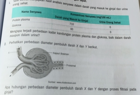 tepal. 
orang sehat. 
jujikall hásil analisis senyawa dal 
lasma dan glukosa, baik dalam darah 
m 
2. Perhatikan perbedaan diameter pembuln Y berikut. 
Sumber: ww.shutferstock.com 
Apa hubungan perbedaan diameter pembuluh darah X dan Y dengan proses filtrasi pada 
ginjal?