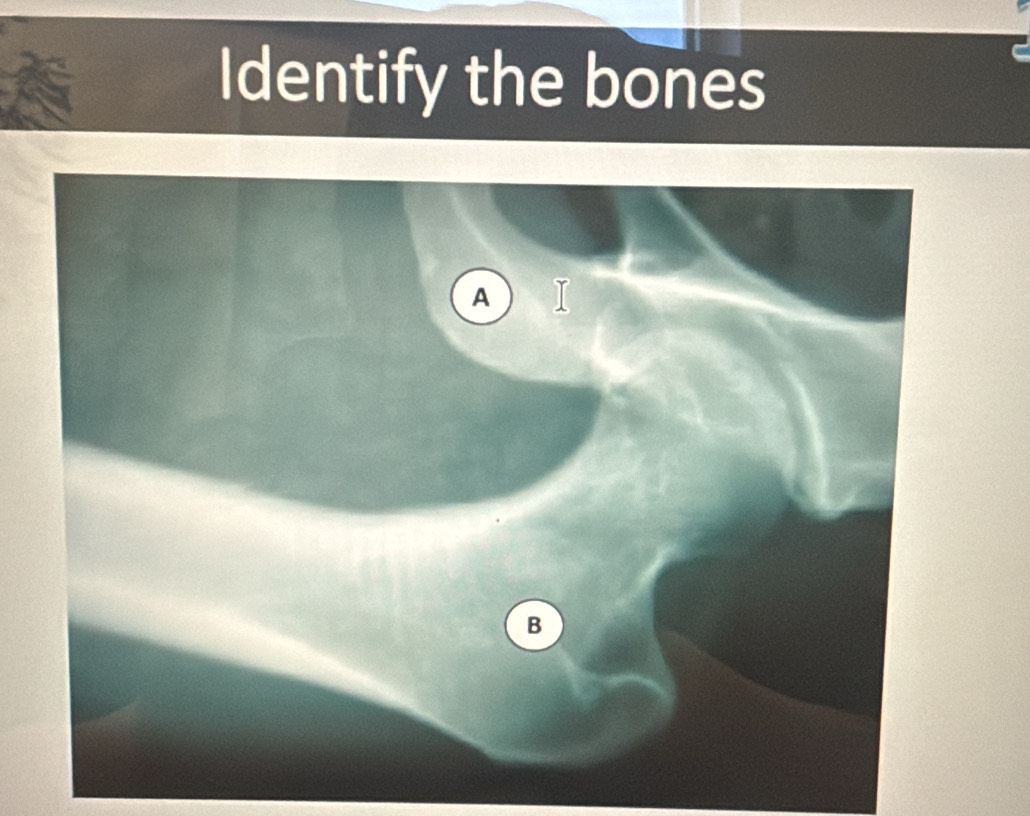 Identify the bones