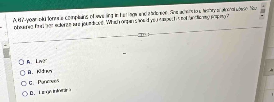 A 67-year-old female complains of swelling in her legs and abdomen. She admits to a history of alcohol abuse. You
observe that her sclerae are jaundiced. Which organ should you suspect is not functioning properly?
A. Liver
B. Kidney
At
C. Pancreas
D. Large intestine
1