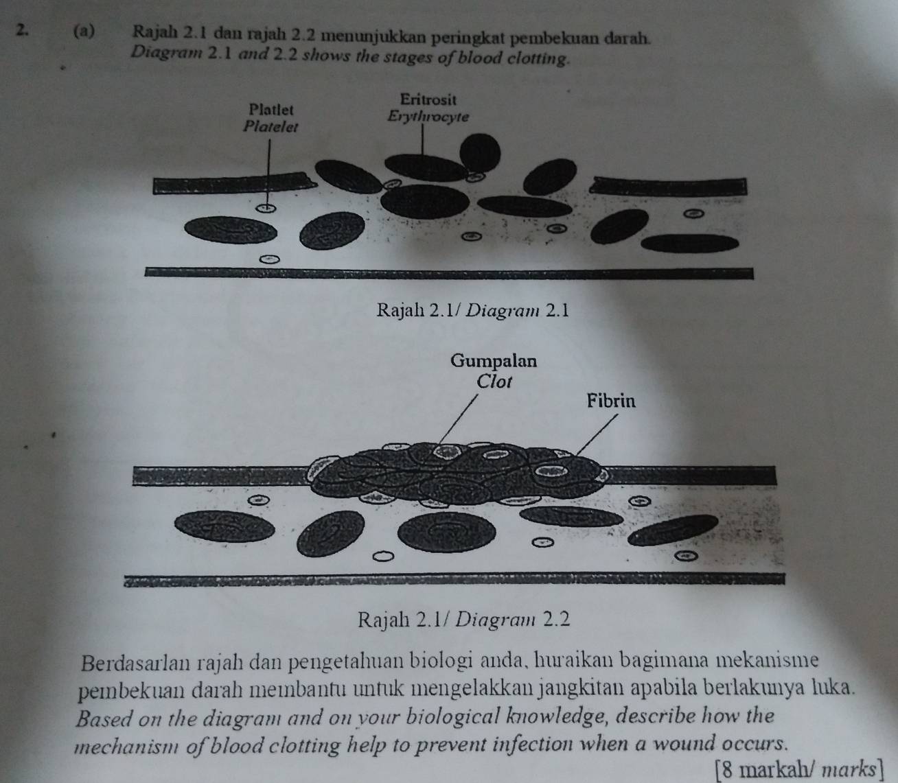 Rajah 2.1 dan rajah 2.2 menunjukkan peringkat pembekuan darah. 
Diagram 2.1 and 2.2 shows the stages of blood clotting. 
Rajah 2.1/ Diagram 2.1 
Rajah 2.1/ Diagram 2.2 
Berdasarlan rajah dan pengetahuan biologi anda, huraikan bagimana mekanisme 
pembekuan darah meɪbantu untuk mengelakkan jangkitan apabila berlakunya luka. 
Based on the diagram and on your biological knowledge, describe how the 
mechanism of blood clotting help to prevent infection when a wound occurs. 
[8 markah/ marks]