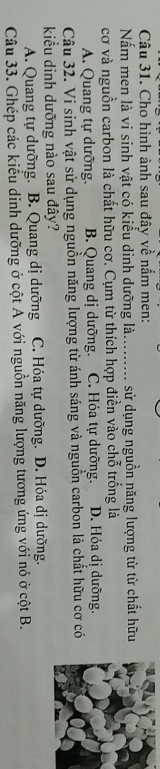 Cho hình ảnh sau đây về nấm men:
Nấm men là vi sinh vật có kiểu dinh dưỡng là......... sử dụng nguồn năng lượng từ từ chất hữu
cơ và nguồn carbon là chất hữu cơ. Cụm từ thích hợp điền vào chỗ trống là
A. Quang tự dưỡng. B. Quang dị dưỡng. C. Hóa tự dưỡng. D. Hóa dị dưỡng.
Câu 32. Vi sinh vật sử dụng nguồn năng lượng từ ánh sáng và nguồn carbon là chất hữu cơ có
kiểu dinh dưỡng nào sau đây?
A. Quang tự dưỡng. B. Quang dị dưỡng C. Hóa tự dưỡng. D. Hóa dị dưỡng.
Câu 33. Ghép các kiểu dinh dưỡng ở cột A với nguồn năng lượng tương ứng với nó ở cột B.