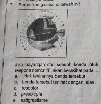 Perhatikan gambar di bawah ini!
Jika bayangan dari sebuah benda jatuh,
respons nomor 18, akan berakibat pada ....
a. tidak terlihatnya benda tersebut
b. benda tersebut terlihat dengan jelas
c. reseptor
d. presbiopia
e. astigmatisme