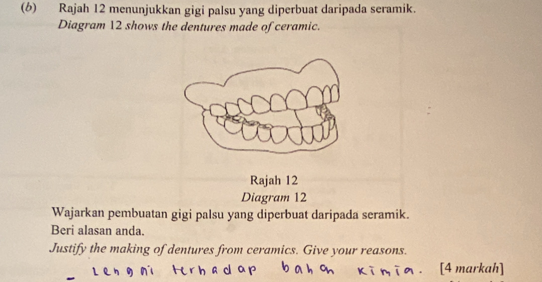 Rajah 12 menunjukkan gigi palsu yang diperbuat daripada seramik. 
Diagram 12 shows the dentures made of ceramic. 
Rajah 12 
Diagram 12 
Wajarkan pembuatan gigi palsu yang diperbuat daripada seramik. 
Beri alasan anda. 
Justify the making of dentures from ceramics. Give your reasons. 
[4 markah]