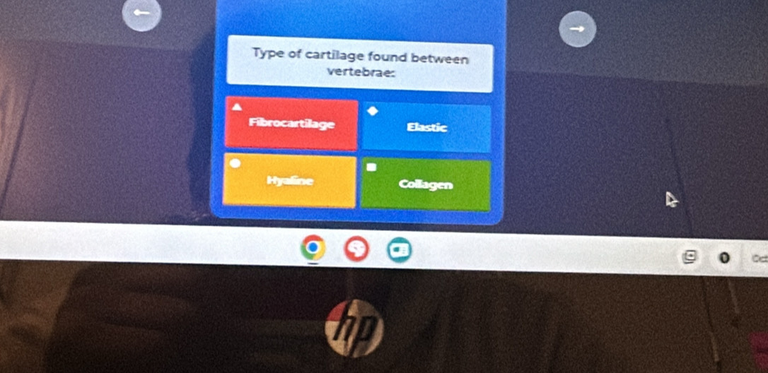 Type of cartilage found between
vertebrae:
Fibrocartilage Elastic
Hyaline Collagen