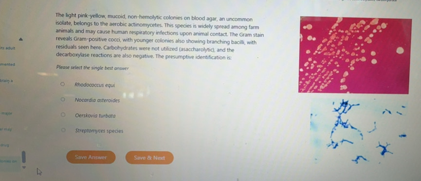 solved-the-light-pink-yellow-mucoid-non-hemolytic-colonies-on-blood