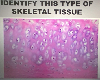 IDENTIFY THIS TYPE OF 
SKELETAL TISSUE