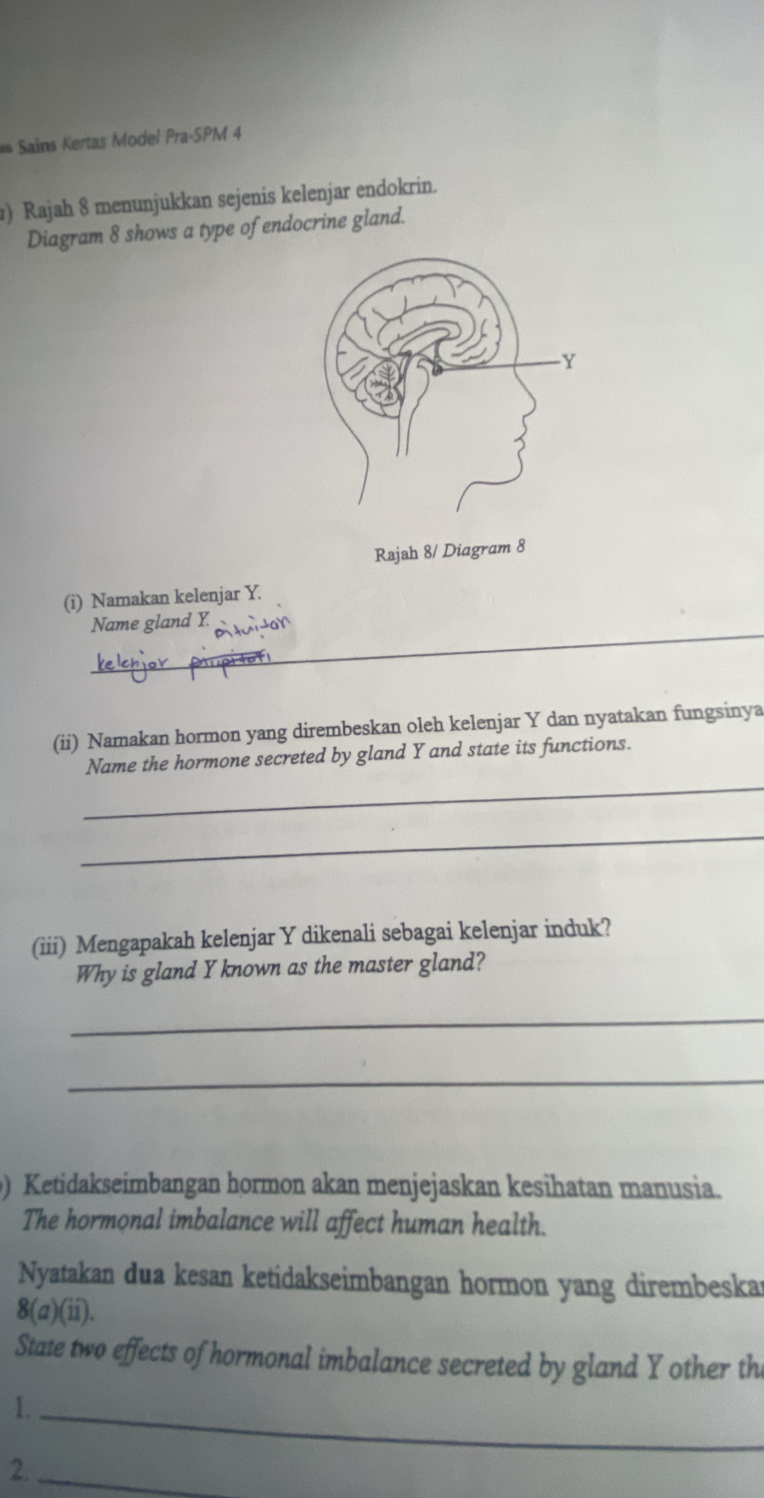 Sains Kertas Model Pra-SPM 4 
) Rajah 8 menunjukkan sejenis kelenjar endokrin. 
Diagram 8 shows a type of endocrine gland. 
Rajah 8/ Diagram 8 
(i) Namakan kelenjar Y. 
_ 
Name gland Y. 
(ii) Namakan hormon yang dirembeskan oleh kelenjar Y dan nyatakan fungsinya 
_ 
Name the hormone secreted by gland Y and state its functions. 
_ 
(iii) Mengapakah kelenjar Y dikenali sebagai kelenjar induk? 
Why is gland Y known as the master gland? 
_ 
_ 
) Ketidakseimbangan hormon akan menjejaskan kesihatan manusia. 
The hormonal imbalance will affect human health. 
Nyatakan dua kesan ketidakseimbangan hormon yang dirembeska 
8(a)(ii). 
State two effects of hormonal imbalance secreted by gland Y other th 
1._ 
2._