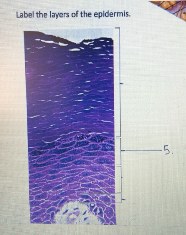Solved: Label the layers of the epidermis. [Biology]