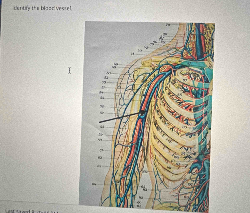 Identify the blood vessel.
68
Last saved 8:20:4