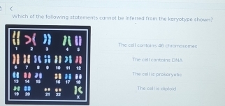 Which of the following statements cannot be inferred from the karyotype shown?
The cell contains 46 chromosames
2
The cell contains DNA
10 1 12 The cell is prokaryatic
15 16 17.. .
19 21 22 x The cell is diplo d