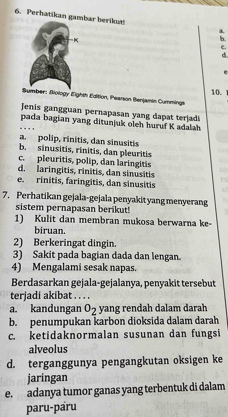 Perhatikan gambar berikut!
a.
b.
C.
d.
e
10.
Sumber: Biology Eighth Edition, Pearson Benjamin Cummings
Jenis gangguan pernapasan yang dapat terjadi
pada bagian yang ditunjuk oleh huruf K adalah
a. polip, rinitis, dan sinusitis
b. sinusitis, rinitis, dan pleuritis
c. pleuritis, polip, dan laringitis
d. laringitis, rinitis, dan sinusitis
e. rinitis, faringitis, dan sinusitis
7. Perhatikan gejala-gejala penyakit yang menyerang
sistem pernapasan berikut!
1) Kulit dan membran mukosa berwarna ke-
biruan.
2) Berkeringat dingin.
3) Sakit pada bagian dada dan lengan.
4) Mengalami sesak napas.
Berdasarkan gejala-gejalanya, penyakit tersebut
terjadi akibat . . . .
a. kandungan o_2 yang rendah dalam darah
b. penumpukan karbon dioksida dalam darah
c. ketidaknormalan susunan dan fungsi
alveolus
d. terganggunya pengangkutan oksigen ke
jaringan
e. adanya tumor ganas yang terbentuk di dalam
paru-paru