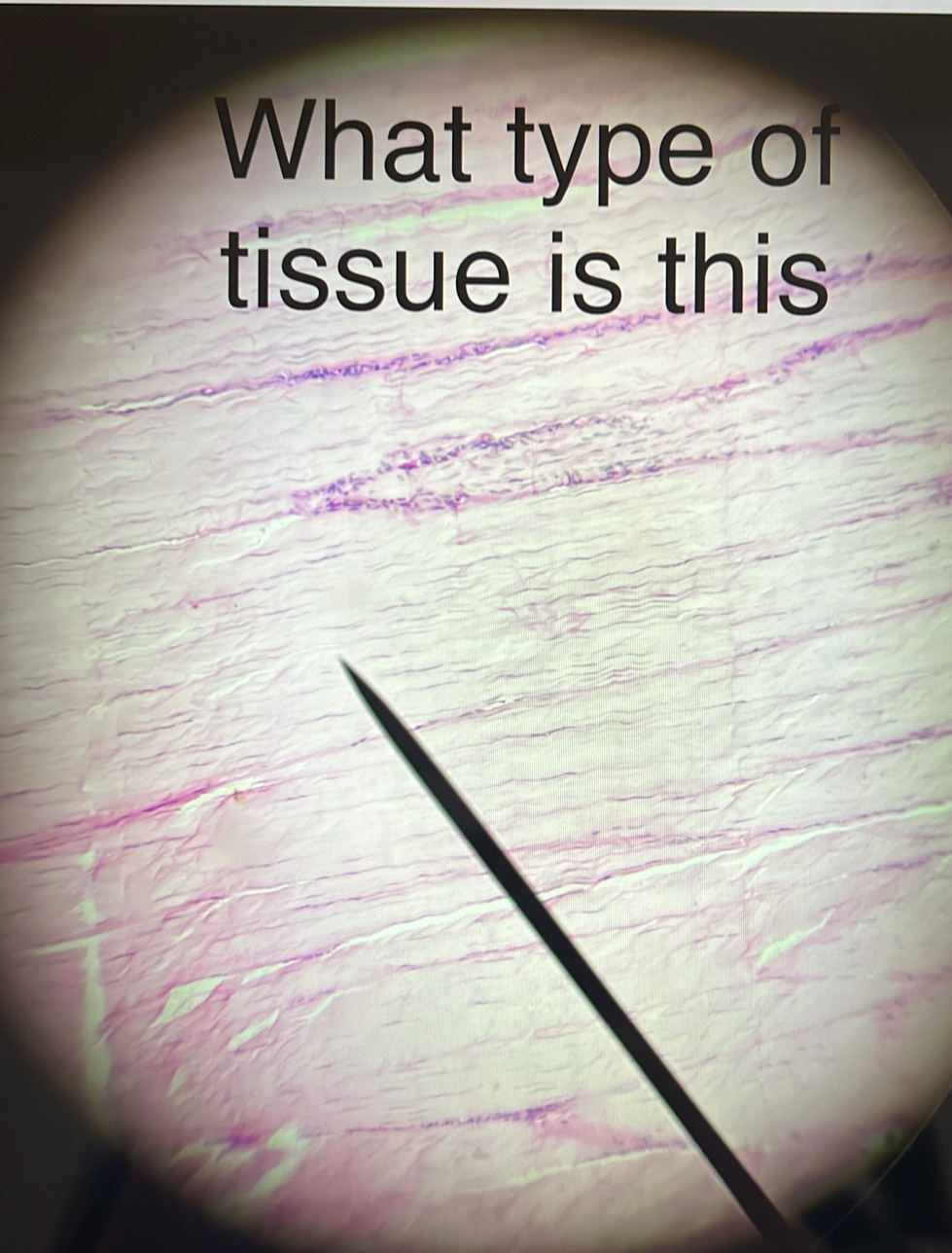 What type of 
tissue is this