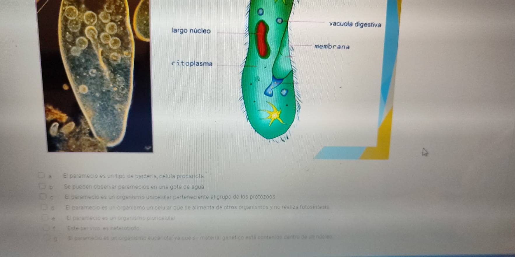 Solved: aEl paramecio es un tipo de bactería, célula procariota b Se puedén  observar paramecios en [Biology]