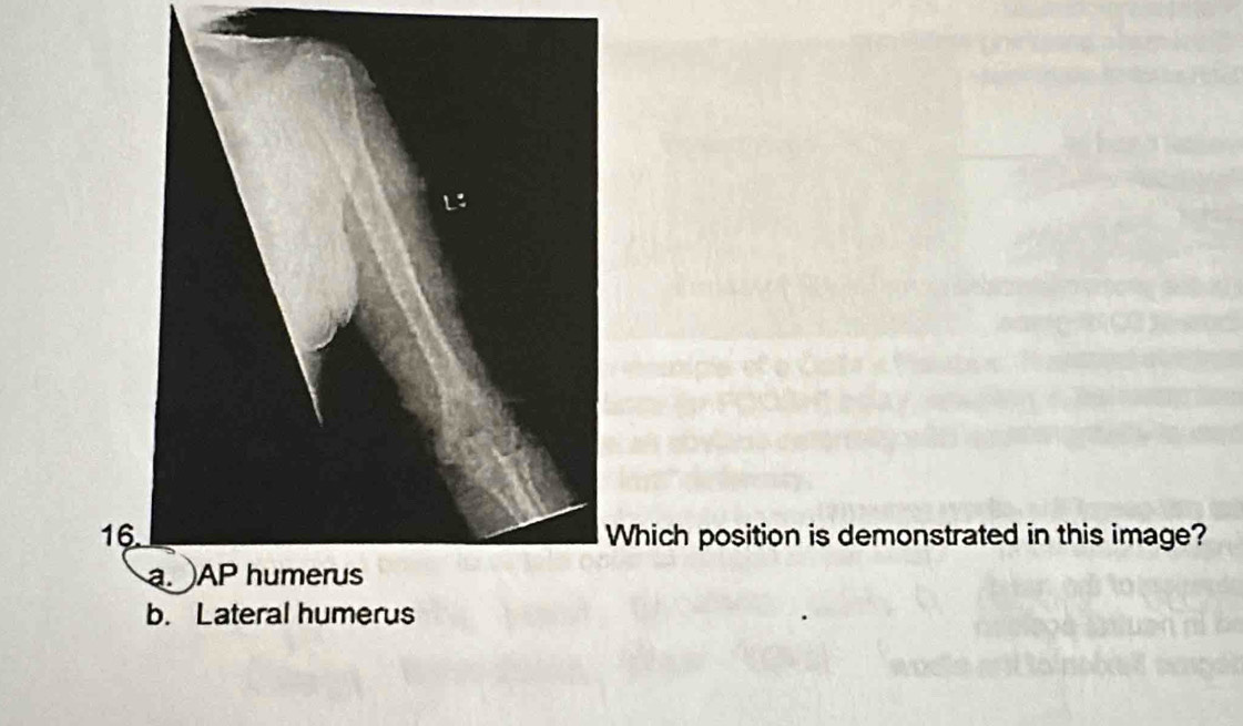 Which position is demonstrated in this image?