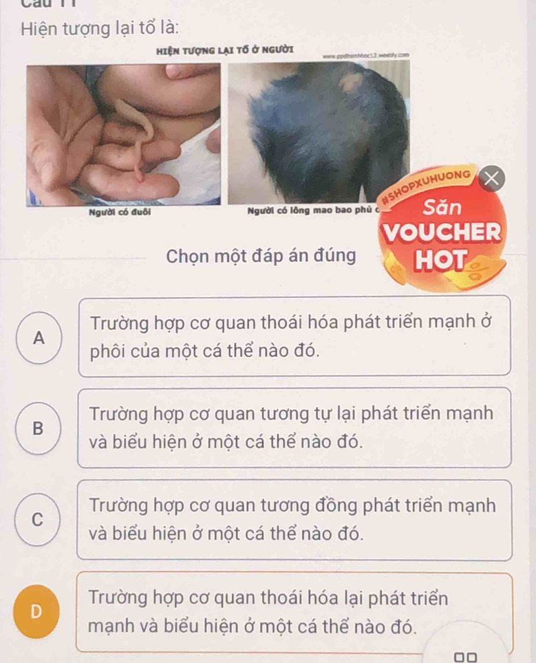 yau
Hiện tượng lại tổ là:
Hiện tượng lại tố ở người bly com
HSHOPXUHUONG
Người có lông mao bao phủ c Săn
VOUCHER
Chọn một đáp án đúng HOT
A Trường hợp cơ quan thoái hóa phát triển mạnh ở
phôi của một cá thể nào đó.
Trường hợp cơ quan tương tự lại phát triển mạnh
B
và biểu hiện ở một cá thể nào đó.
C Trường hợp cơ quan tương đồng phát triển mạnh
và biểu hiện ở một cá thể nào đó.
Trường hợp cơ quan thoái hóa lại phát triển
D mạnh và biểu hiện ở một cá thể nào đó.
□□