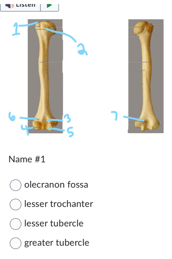 Lislen
Name #1
olecranon fossa
lesser trochanter
lesser tubercle
greater tubercle