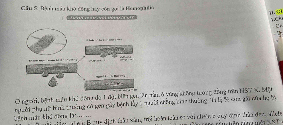 Bệnh máu khó đông hay còn gọi là Hemophilia 
II. GI 
Bệnh máu khó đồng là gi2 
1.Cấ 
- Gl 
- Dạ 
+ 
Ở người, bệnh máu khó đông do 1 đột biến gen lặn nằm ở vùng không tương đồng trên NST X. Một 
người phụ nữ bình thường có gen gây bệnh lấy 1 người chồng bình thường. Tỉ lệ % con gái của họ bị 
bệnh máu khó đông là: :....... 
giám, allele B quy định thân xám, trội hoàn toàn so với allele b quy định thân đen, allele 
a s e nằm trên cùng một NST y