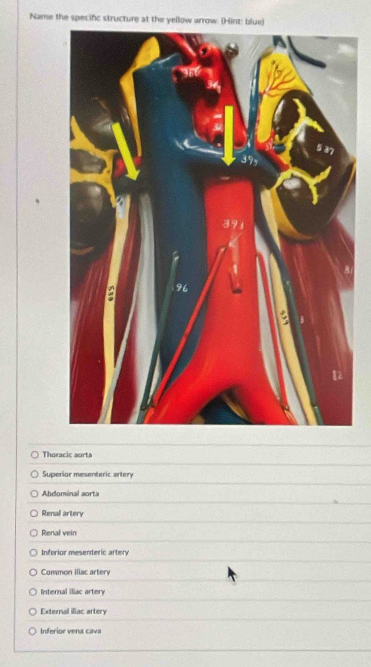 Name the specifc structure at the yellow arrow. (Hint: blue)
Thoracic aorta
Superior mesenteric artery
Abdominal aorta
Renal artery
Renal vein
Inferior mesenteric artery
Common illac artery
Internal illac artery
External iliac artery
Inferior vena cava